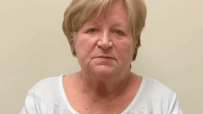 Tardive Dyskinesia: 70-year old woman with tardive dyskinesia displaying oro-buccal-lingual stereotypy