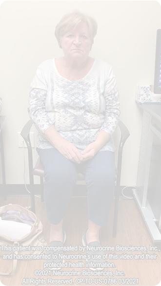 Tardive Dyskinesia- 70-year old woman with tardive dyskinesia displaying oro-buccal-lingual stereotypy