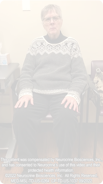 Tardive Dyskinesia- 76-year-old woman with tardive dyskinesia and associated oral pain, showing tongue and mouth movements, bridling, and blepharospasm